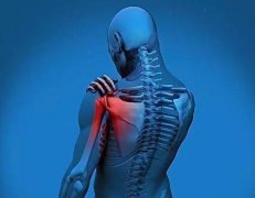 腰肌劳损有什么缓解方式吗？